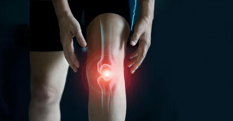 Arthritis Treatment Brisbane